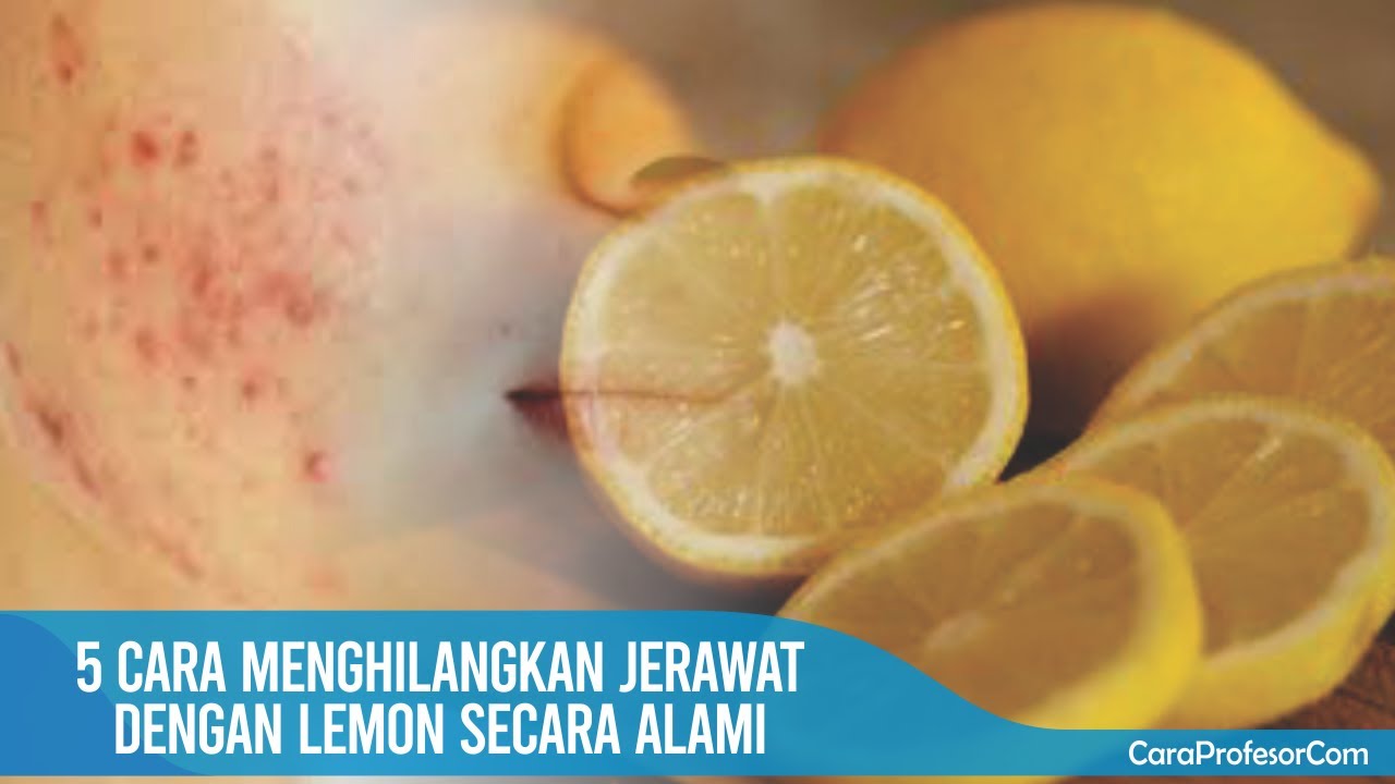 5 Cara menghilangkan jerawat dengan lemon secara alami YouTube