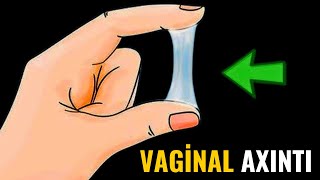 Qadınlarda Vagianal Axıntı Və Pis Qoxunun Səbəbləri̇