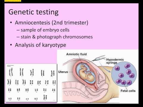 Video: Wat is de ontwikkeling van kinderen van het exosysteem?