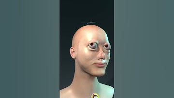 brain nerve aneurysm exploding meme but cringy bald guy