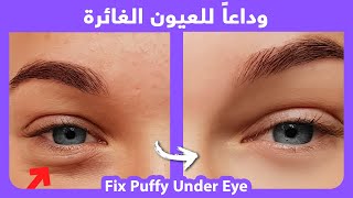 How to naturally get rid of puffy lower eyelids, wrinkles |  التخلص من العيون الغائرة بطريقة طبيعية