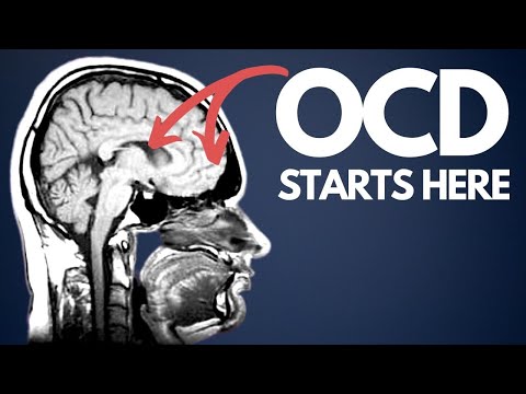 OCD explained for beginners - how I wish I was taught