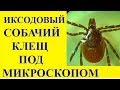 Эти Клещи Вас Сожрут! Клещ Под Микроскопом:  Ixodes ricinus