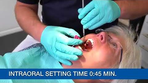 Two Step Impression Using Kettenbach Materials