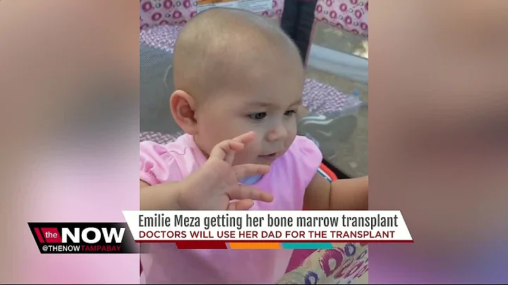 1-year-old Emilie Meza getting bone marrow transplant