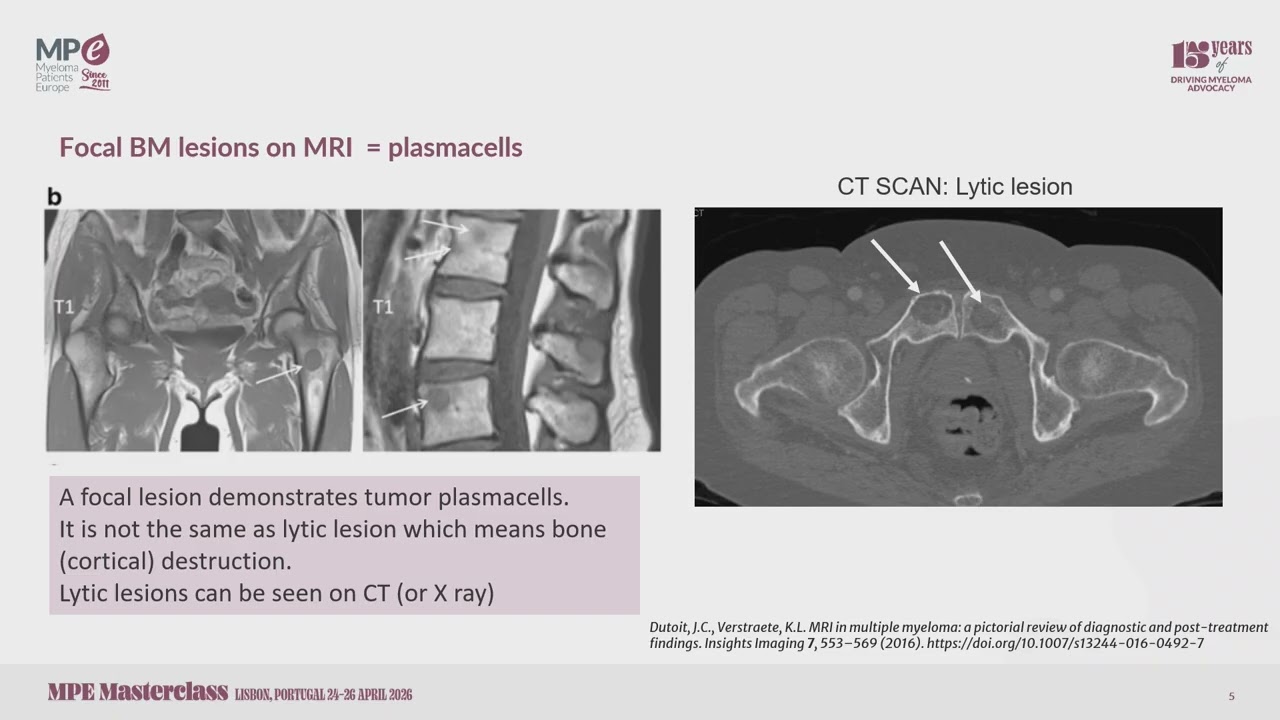 MPE Masterclass 2026 - Myeloma-related conditions with Dr Monique Minnema