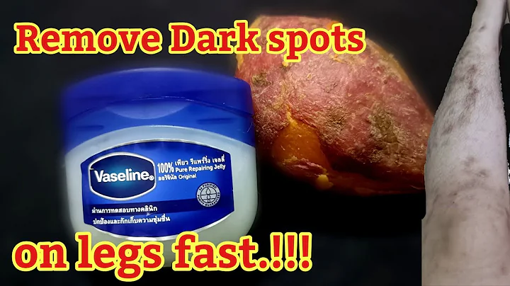 Only 1-2 days! How to remove Dark spots on legs,Scar, Mosquito Bites, Hyperpigmentation on legs fast