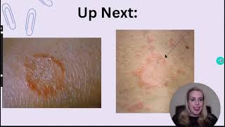 NP Learning - Picture Comparisons Made Easy: Tips and Tricks for Your NP Board Review ❤️