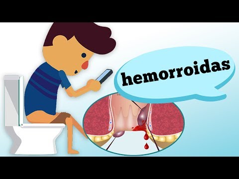 Vídeo: Como identificar os sintomas de hemorróidas (com fotos)