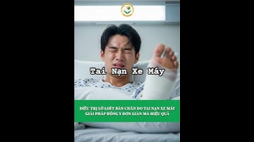 💡 Vết loét bàn chân khó lành – Hồi phục kỳ diệu nhờ Cao dán Đông Dr. Dư Tuy