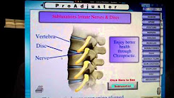 arthritis explained by Dr. Maggio-chiropractor Virginia Beach