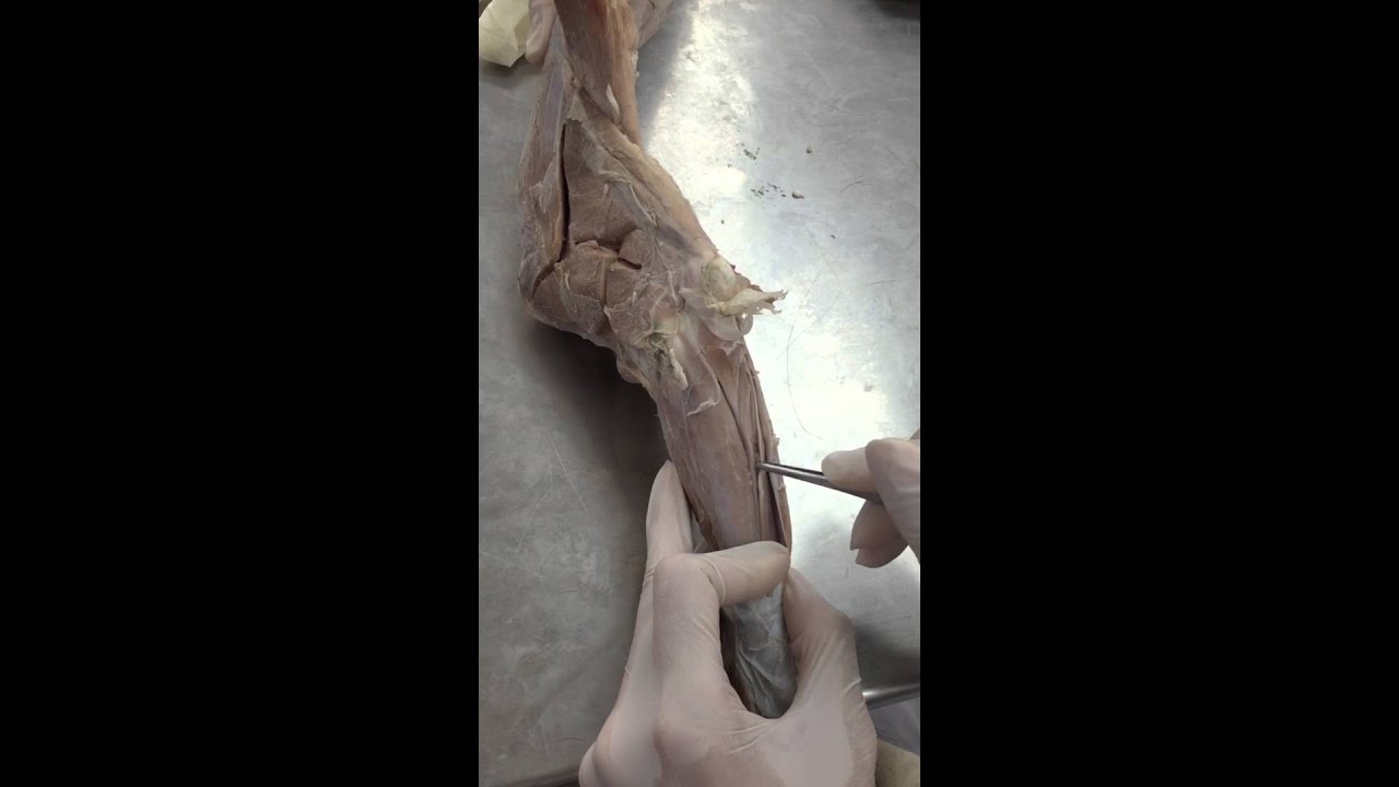 antebrachium