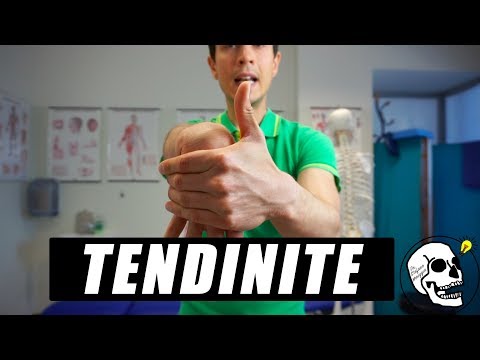 Video: Tendinite: Cause, Diagnosi E Prevenzione