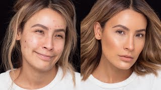 FLAWLESS SKIN WITH ACNE BREAKOUTS | DESI PERKINS