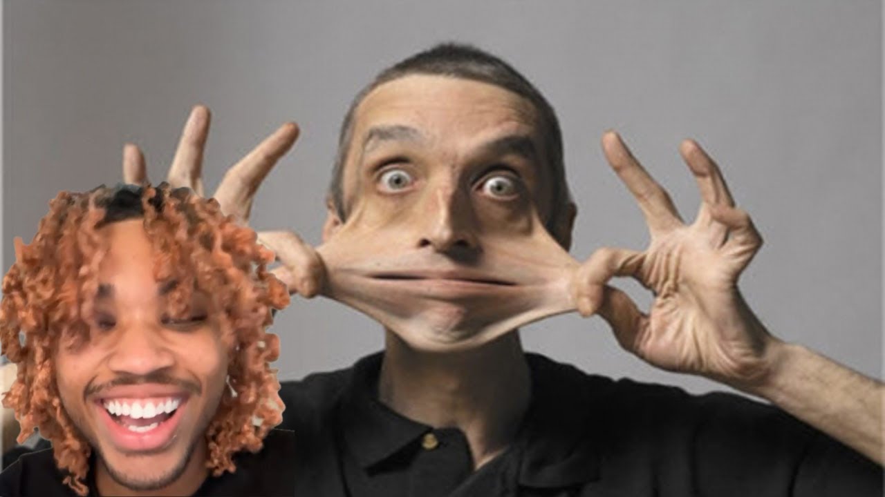 He Has Really Stretchy Skin  | Daily Dose Reaction