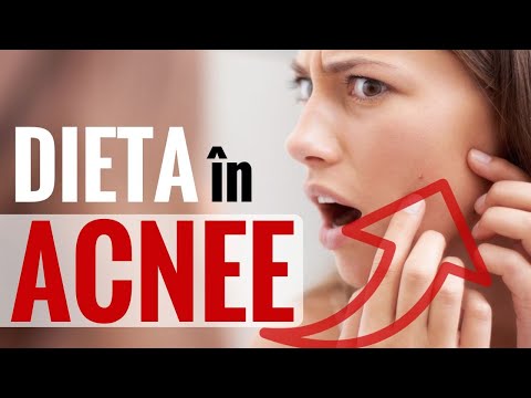 Video: 6 moduri de a vindeca acnee cruste