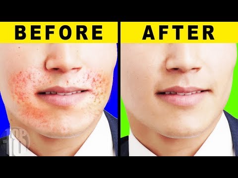 I Got Perfect Skin After Trying These Tips