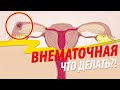 Внематочная беременность: что делать?