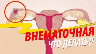 Внематочная беременность: что делать?