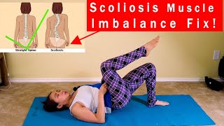 One Side Glutes Weakness Due to Scoliosis and Low Back Pain Muscle Imbalance Program