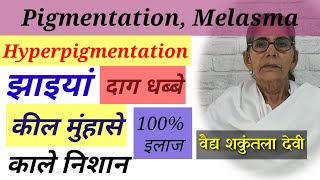 Pigmentation, Melasma, झाइयां, काले निशान, दाग धब्बे, hyperpigmentation, jhaiya, WhatsApp@9466528879 screenshot 3