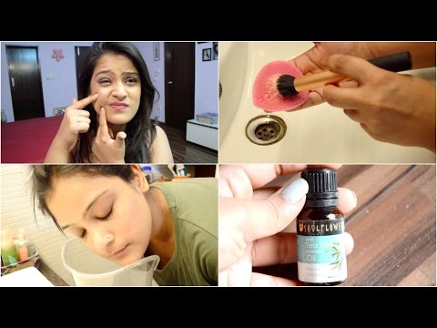 How To Get Rid of Pimples | Treat Acne Scars | Natural Remedies