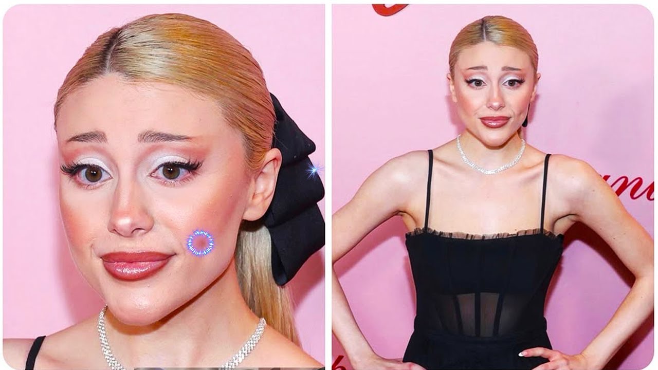 PLASTIC SURGERY NIGHTMARES That Destroyed Famous Faces? YouTube