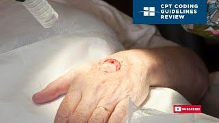 CPT Coding Guidelines Review: Skin Replacement Surgery