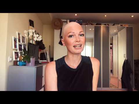 Video: 10 Mythen über Männliche Alopezie