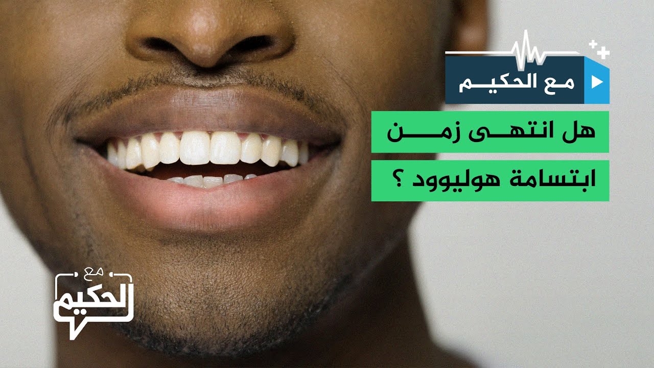 هل انتهى زمن "ابتسامة هوليوود"؟ د. أمير عويس يكشف الحقائق
