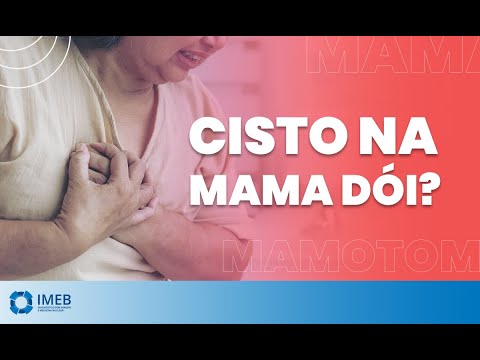 Vídeo: Cisto No Peito - Causas, Sintomas E Tratamento De Cistos No Peito Com Remédios Populares