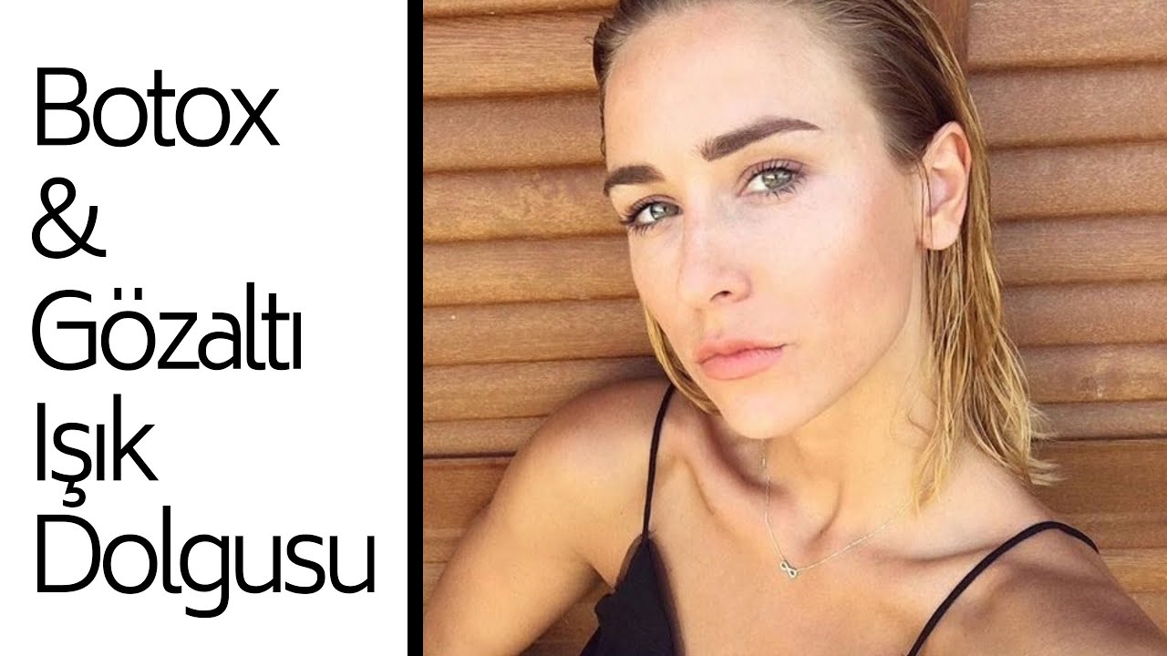 Ilk Botox Ve Gozalti Isik Dolgusu Deneyimim Oncesi Sonrasi Ve Fiyatlar Youtube