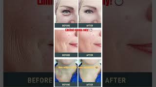 My Skin in Just 2 Weeks with SeriSkin ✨[Real Results] #seriskin #seriskinsupplement #antiagingsecret