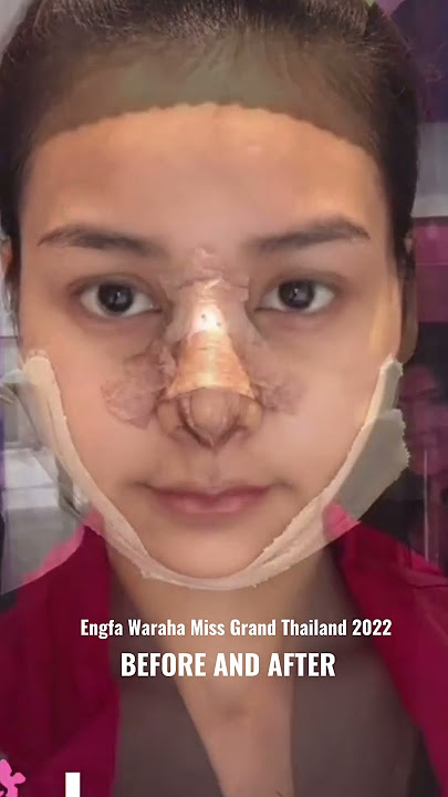 Engfa Waraha before and after from teen to lady #engfawaraha #missgrandthailand2022copy