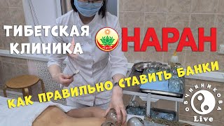 Как правильно ставить банки? Тибетская клиника Наран