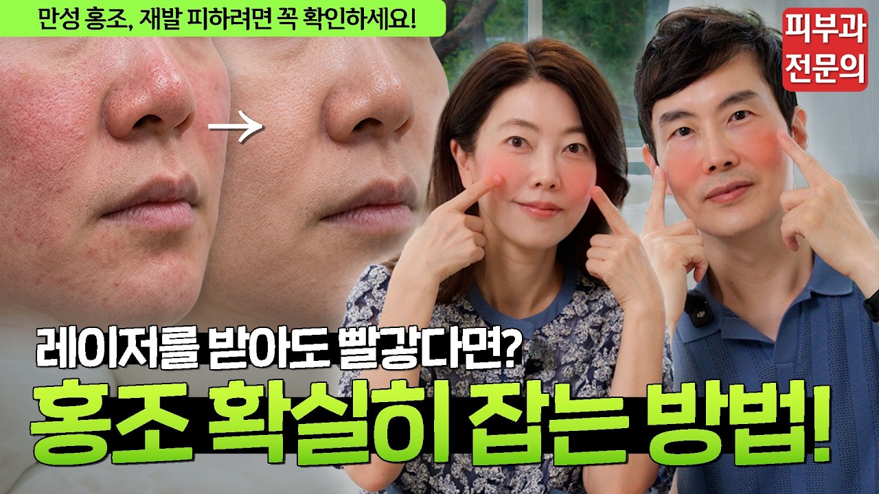 안면홍조, 레이저 말고 ‘이것’부터 바꾸세요!