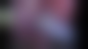 [JMIS] Robotic Lateral Pelvic Lymph Node Dissection: Description of A Technique