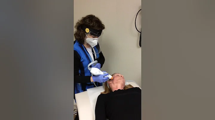 Thermage with Dr. Marina Buckley