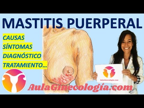 MASTITIS PUERPERAL: SÍNTOMAS, DIAGNÓSTICO, TRATAMIENTO, LACTANCIA... - Ginecología y Obstetricia -