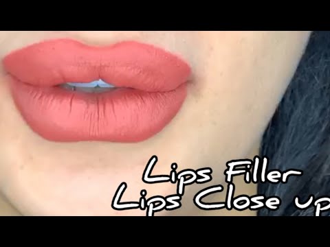 Full Lips Pesona Senyuman Bibir Indah