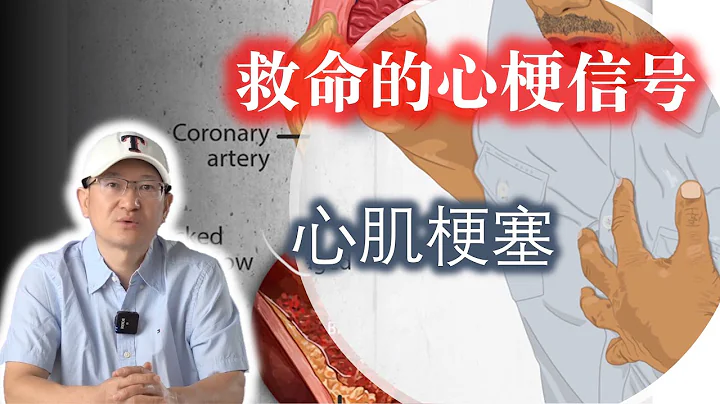 心梗青睞這些人 心梗前兆 預防心梗有方法 心肌梗塞 心肌梗死 過勞死 中年猝死 救命的心梗信號 - 天天要聞