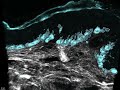 JID October Cover Video: Melanocyte-Keratinocyte Interactions in the Epidermis