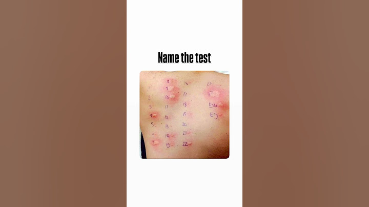 Name the test