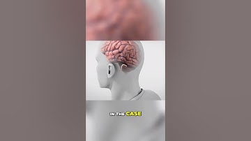 Synchron (Bezos/ Gates) vs. Neuralink (Musk): A Comparison of Brain Access Methods #BCI #Singularity