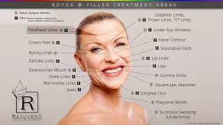 Botox and Filler Injection Areas
