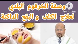وصفة الخرقوم البلدي لعلاج الكلف والبقع الداكنة في الوجه من عند الدكتور عماد ميزاب.
