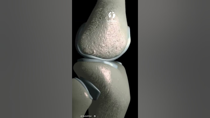 Arthrose du genou : Pourquoi ça fait mal ?