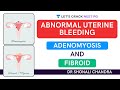 Abnormal Uterine Bleeding - Fibroid Vs Adenomyosis | Target NEET PG 2021 | Dr. Shonali Chandra