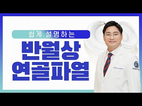 무릎통증, 반월상연골파열 수술이 꼭 필요할까?