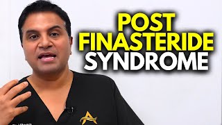 Post Finasteride Syndrome: Is the Incidence Significant?